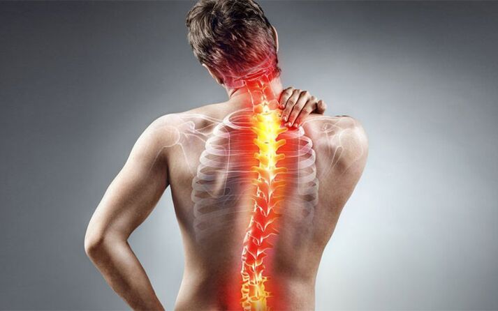 Back pain with scoliosis