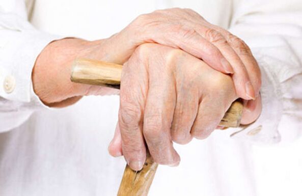 osteoarthritis of the fingers in an elderly person