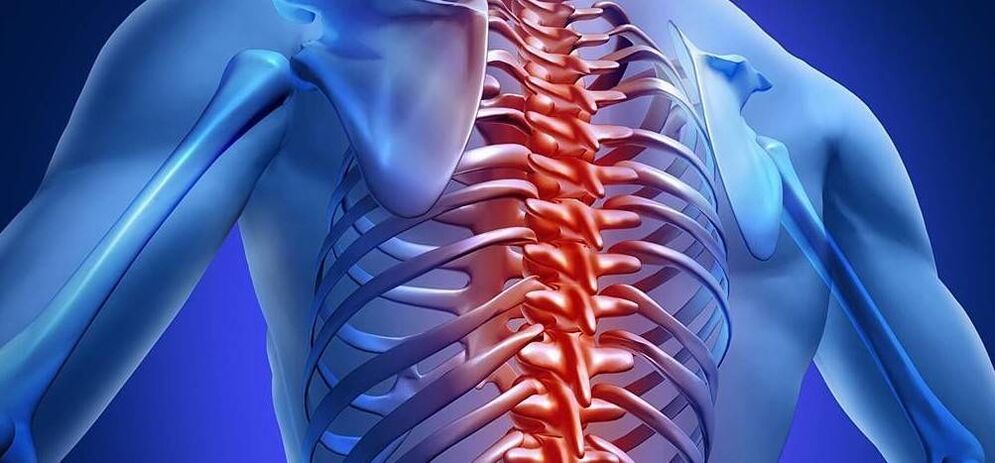 Osteochondrosis of the thoracic spine