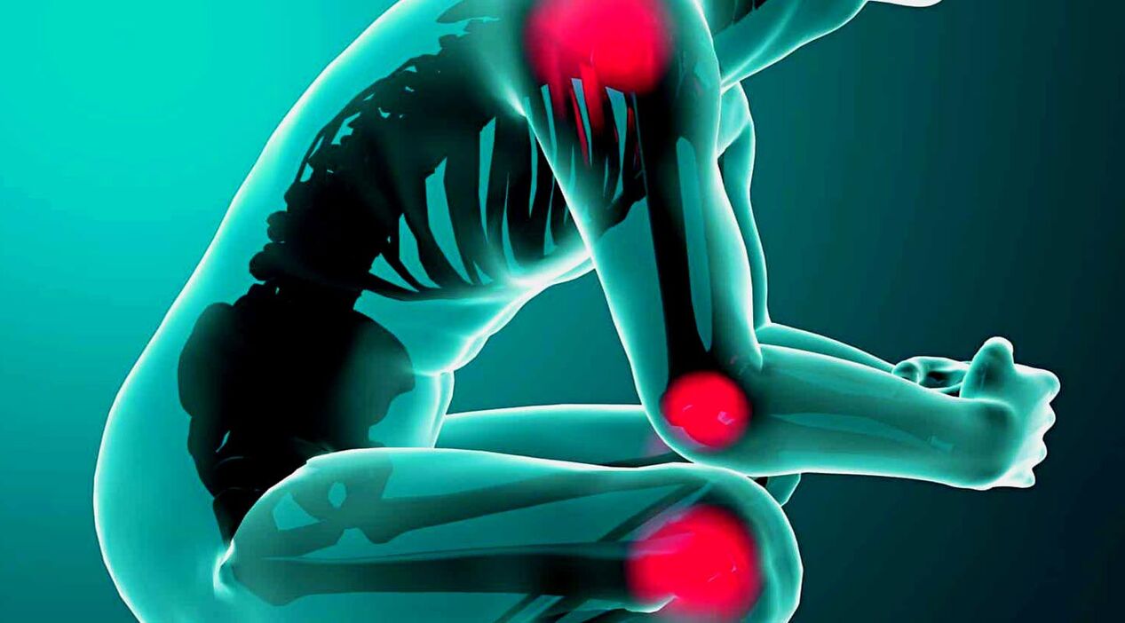 joint pain, treatment with Hondrolife